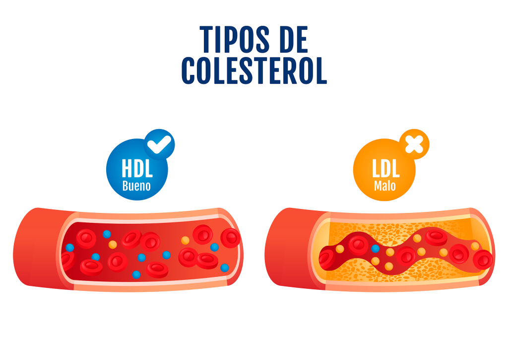 tipos-de-colesterol Colesterol: ¿Amigo o Enemigo? La verdad que no te contaron